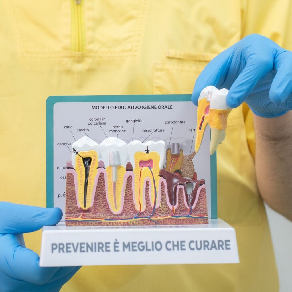 devitalizzazione dente a Torino