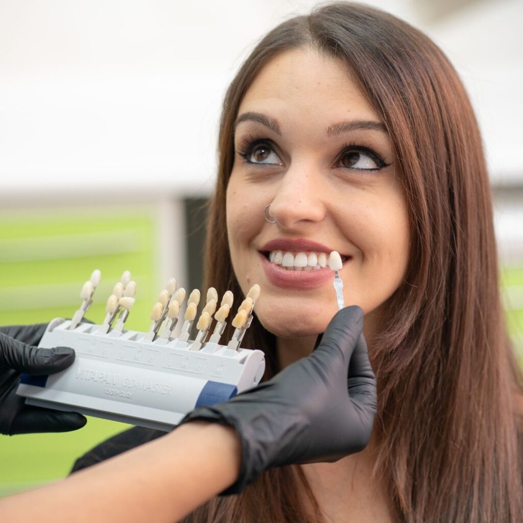Faccette dentali a Torino