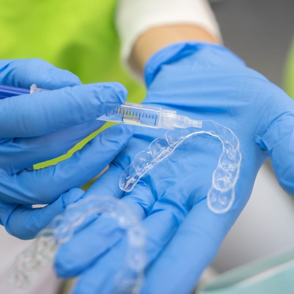 Sbiancamento dentale a Torino