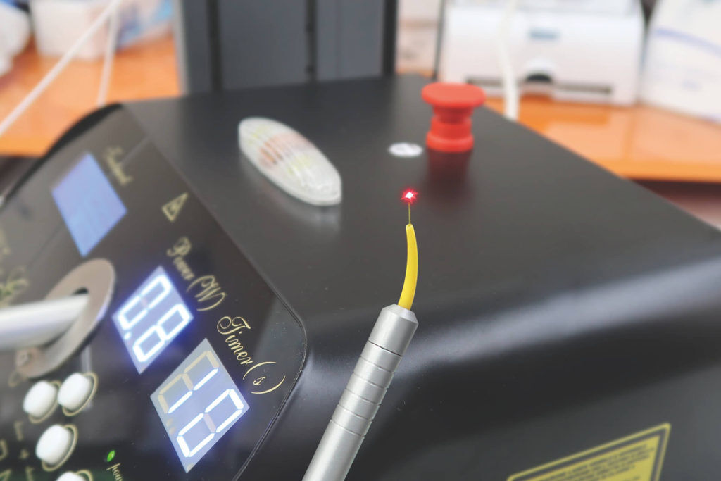 Tecnologie 10 Sonda Laser